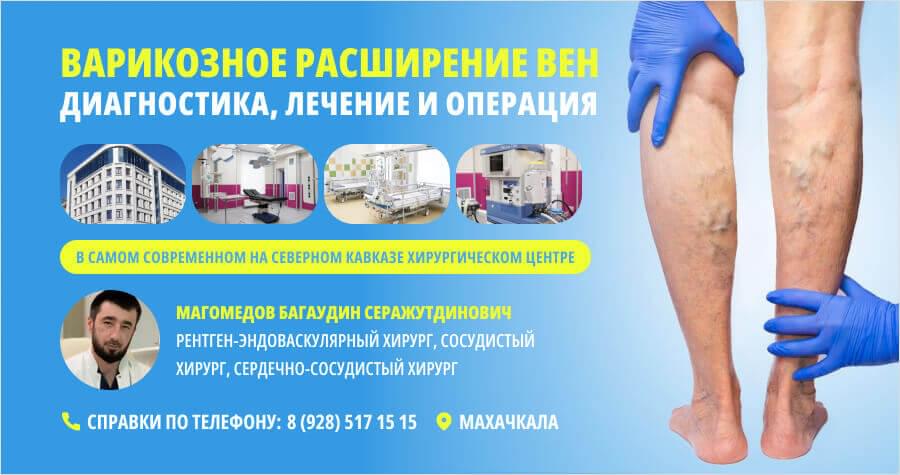 Новейшие методы оперативного лечения варикоза в "Целителе"