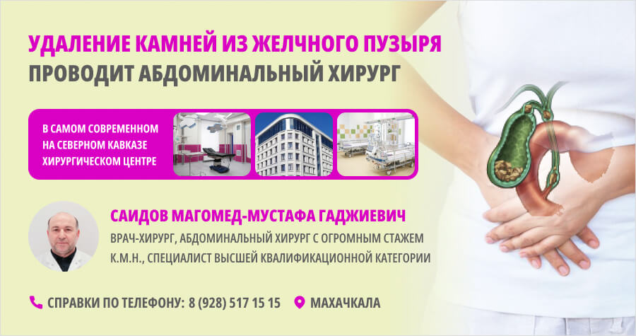 Удаление камней из желчного пузыря